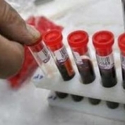     “გაიღე სისხლი გადაარჩინე ბავშვის სიცოცხლე”